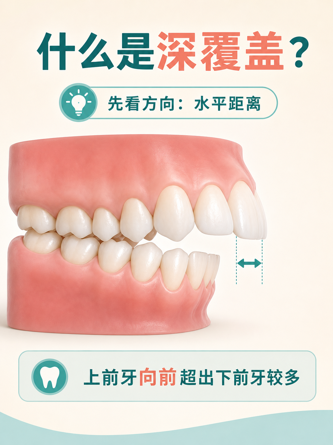什么是深覆盖?先看前牙的水平距离