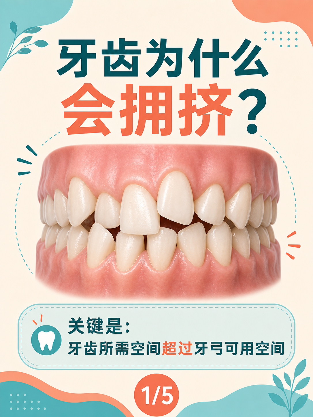 牙齿为什么会拥挤?理解牙弓里的空间关系