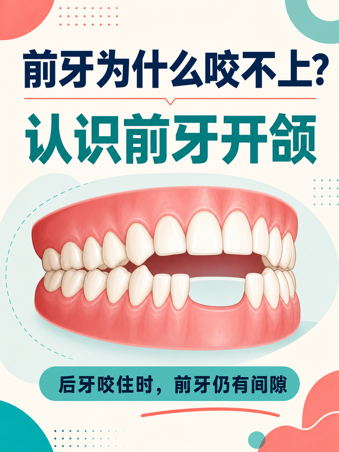 前牙为什么咬不上?认识前牙开颌
