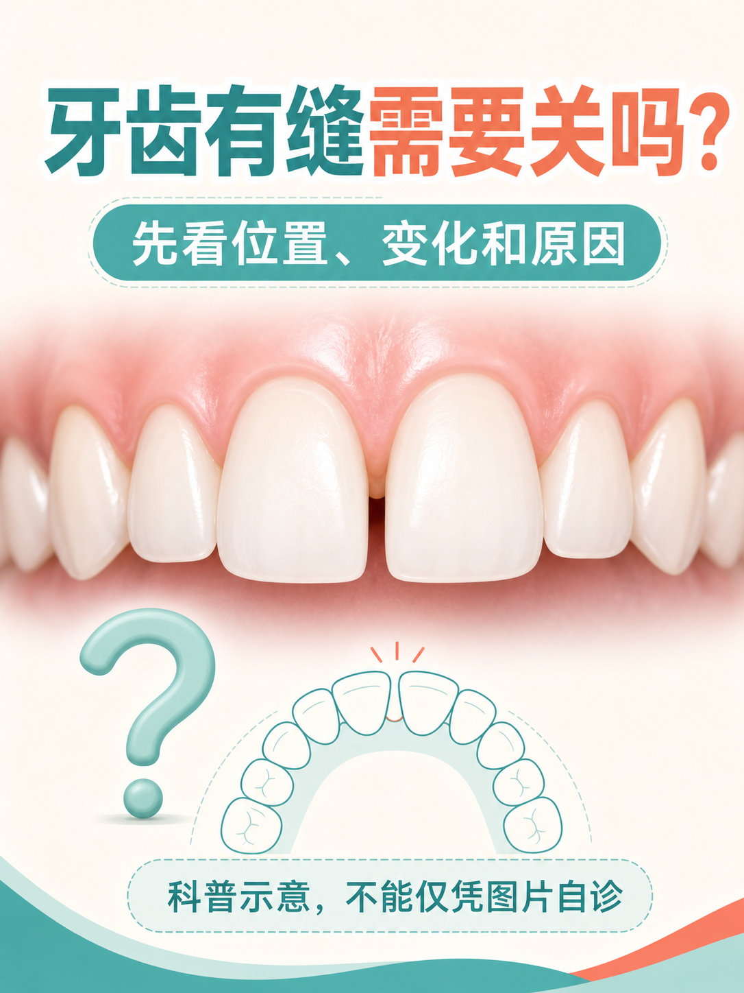 牙齿有缝需要关吗?先看位置、变化和原因