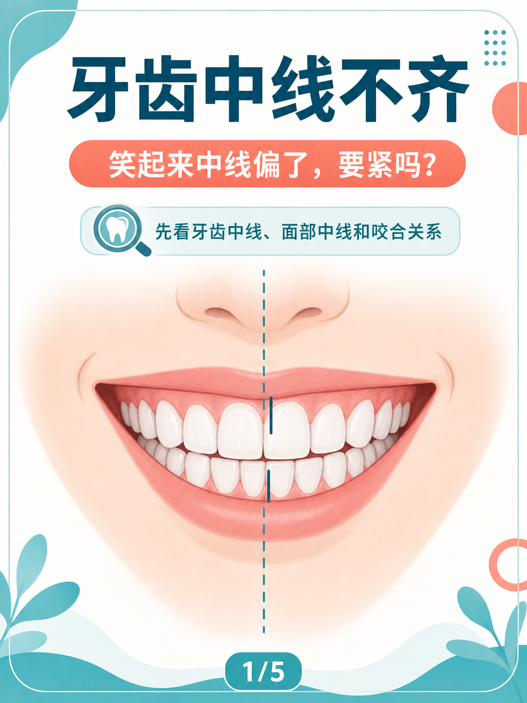 牙齿中线不齐:笑起来中线偏了,要紧吗?