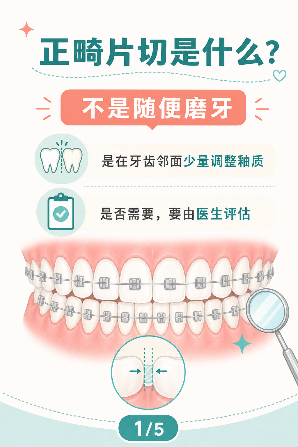 正畸片切是什么?