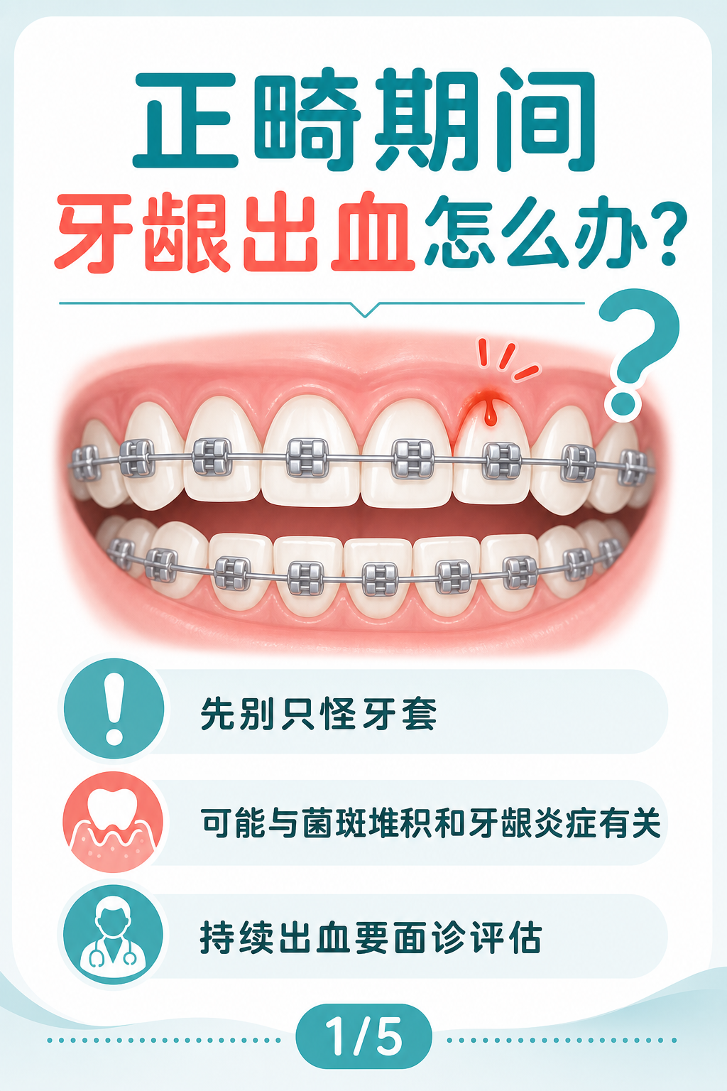 正畸期间牙龈出血怎么办?
