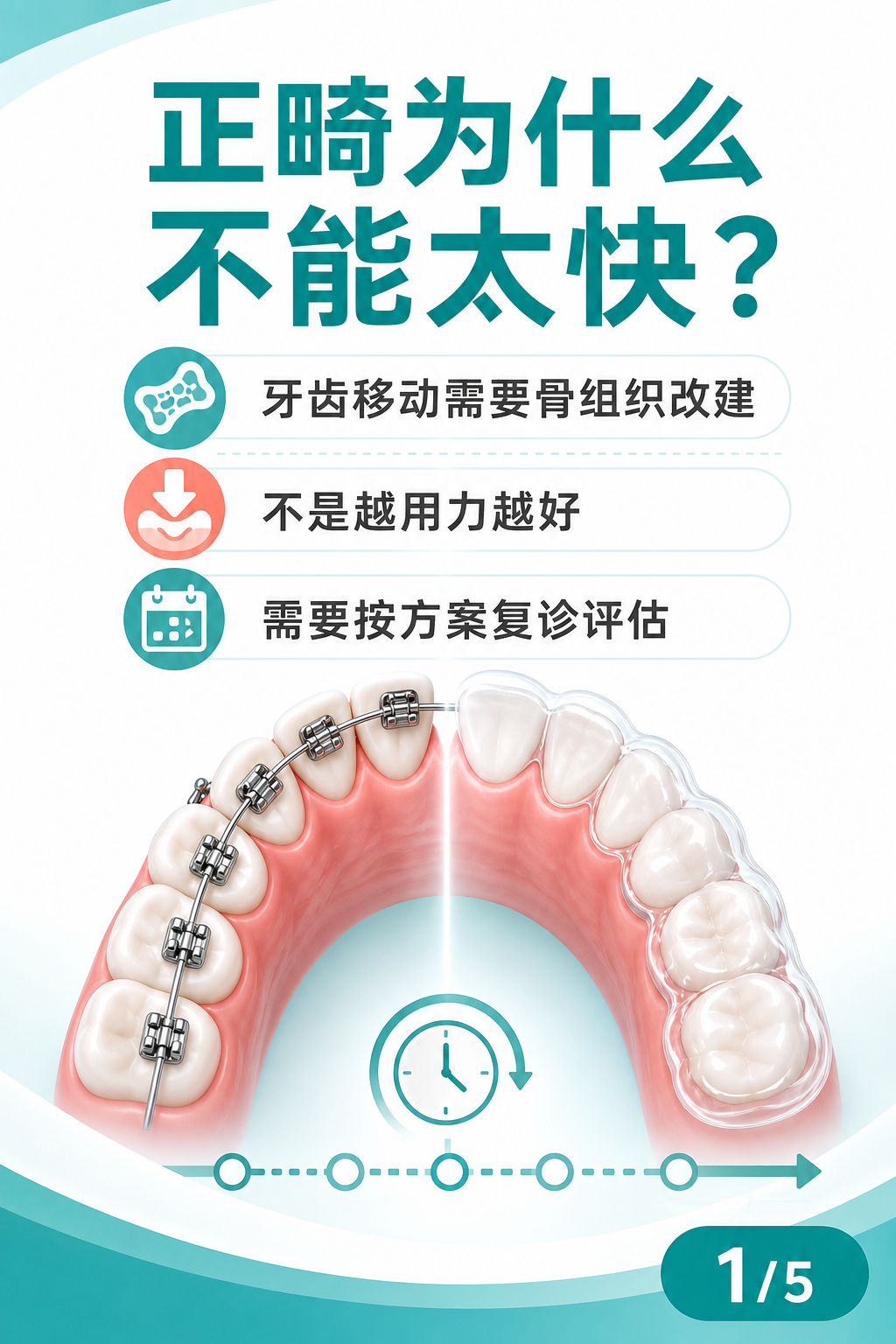 正畸为什么不能太快?