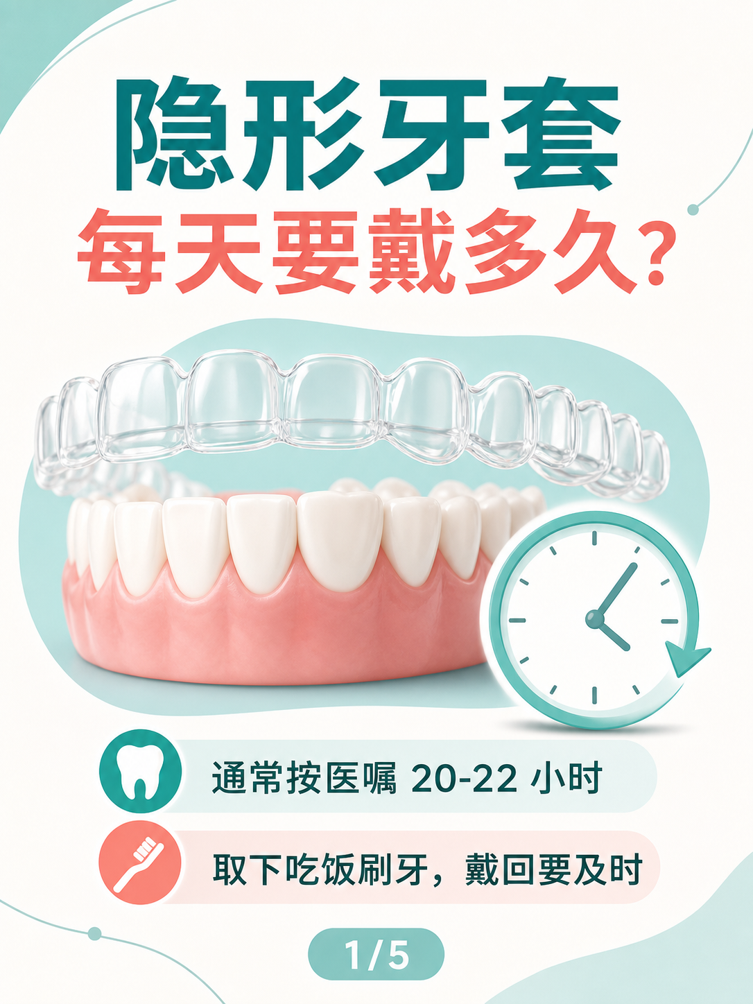 隐形牙套每天要戴多久?