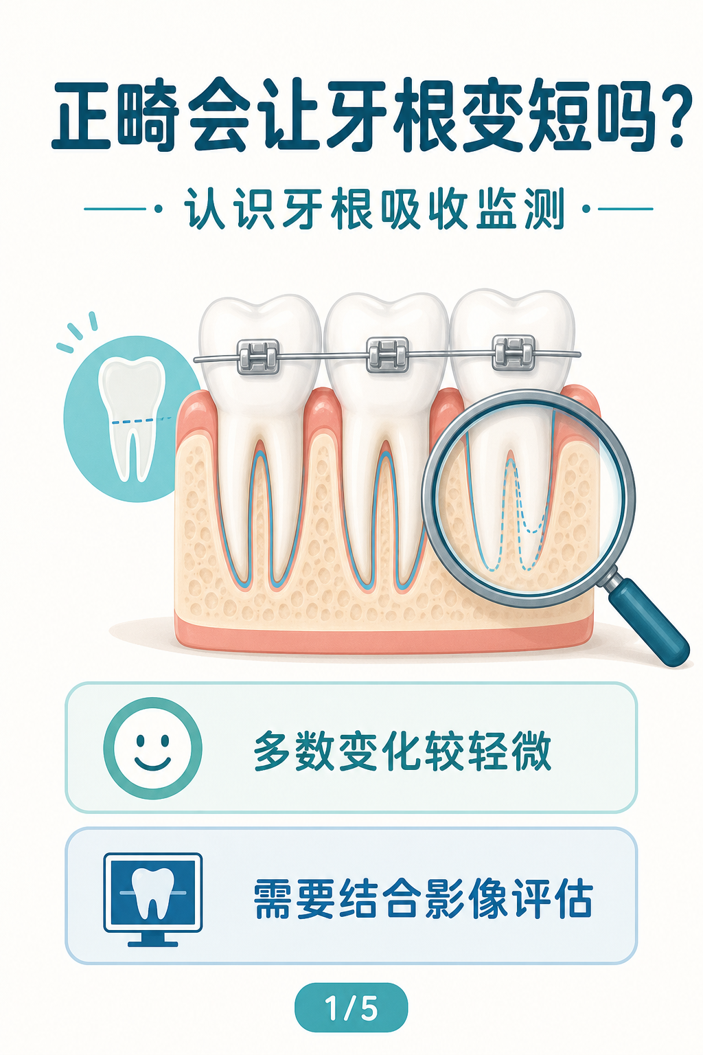 正畸会让牙根变短吗?